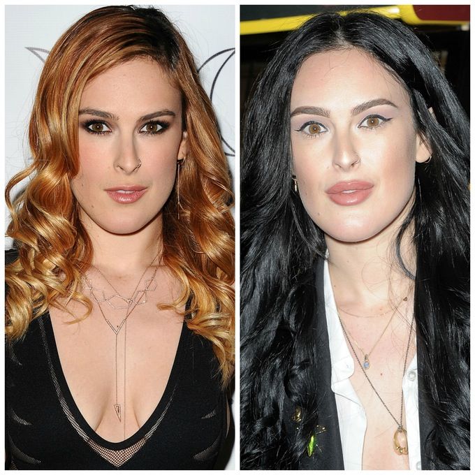rumer willis plastic surgery