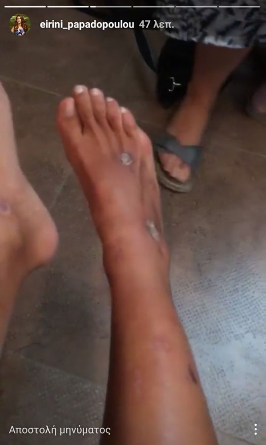 pliges papadopoulou 1