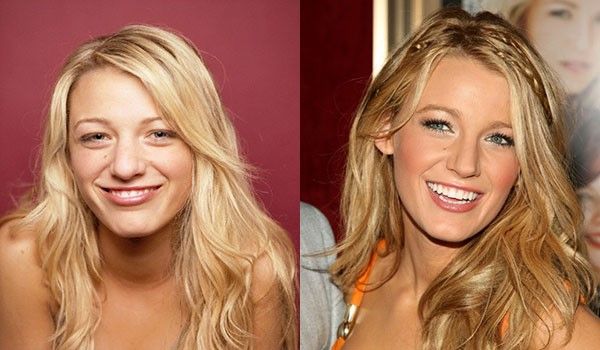 blakeeeeee