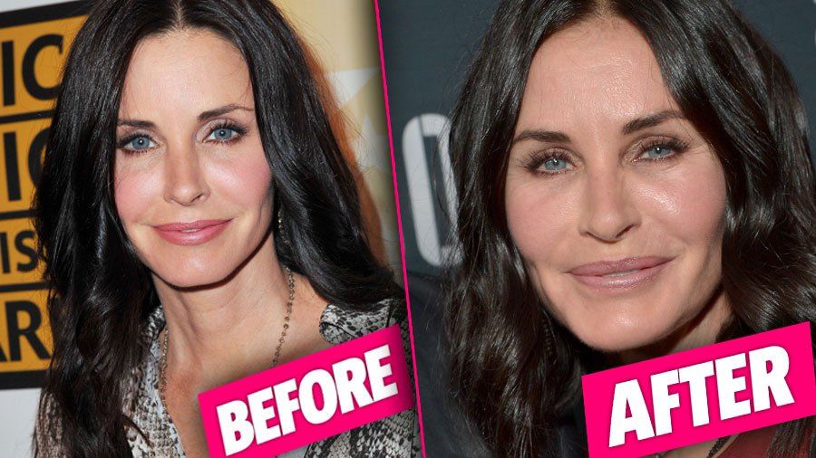 Courtney Cox Plastic Surgery pp 3