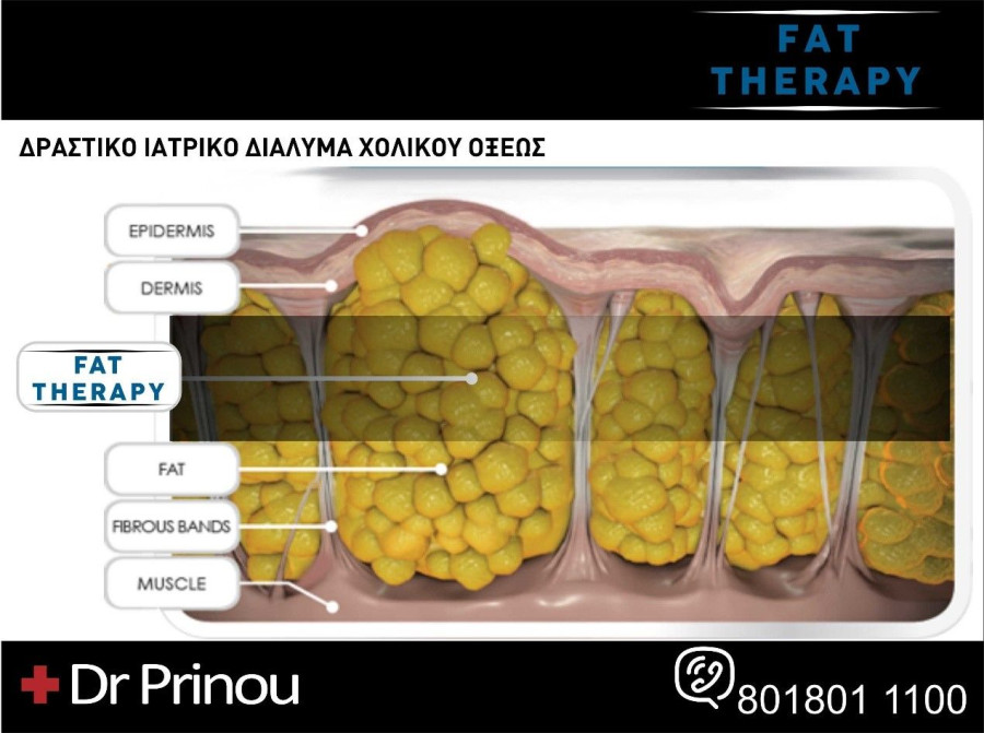 33333333333333333333333