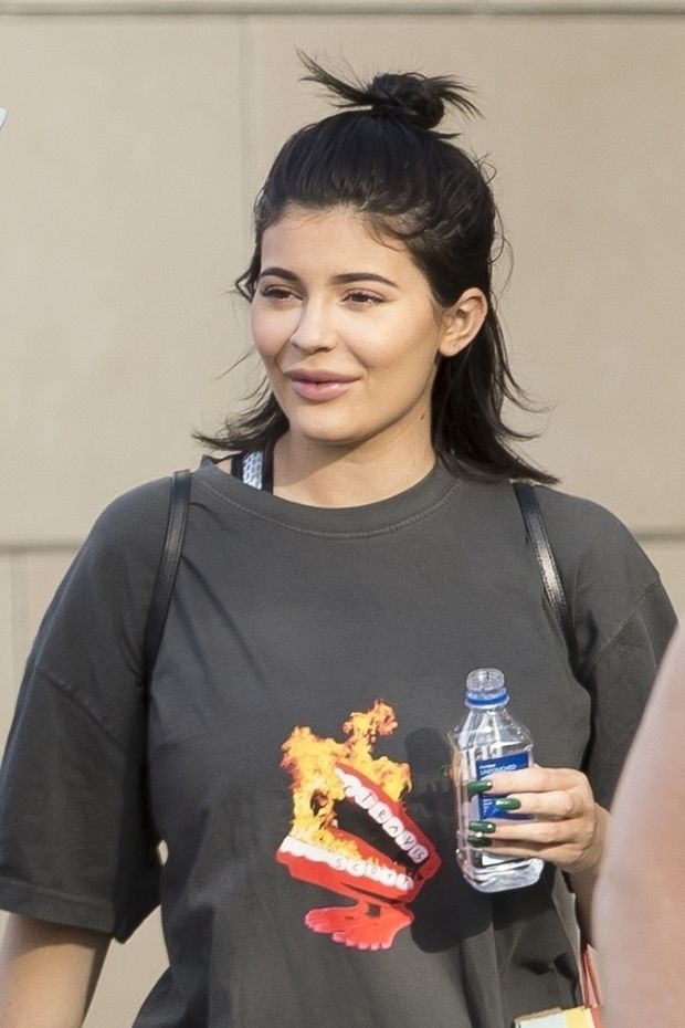 kylie jenner lip fillers embed backgrid