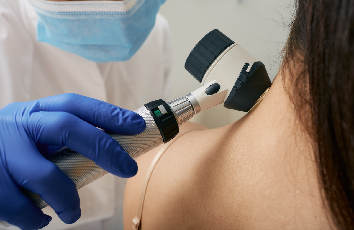 dermatoscopy.png